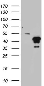 HOXD9 Antibody in Western Blot (WB)