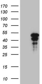 HOXD9 Antibody in Western Blot (WB)
