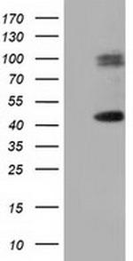 HP Antibody in Western Blot (WB)