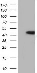 HP Antibody in Western Blot (WB)