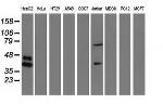 HP Antibody in Western Blot (WB)