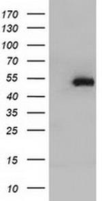 HP Antibody in Western Blot (WB)