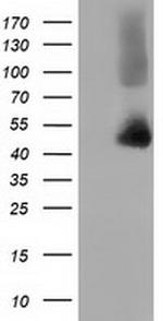 HP Antibody in Western Blot (WB)