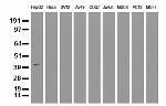 HP Antibody in Western Blot (WB)