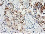 HPGD Antibody in Immunohistochemistry (Paraffin) (IHC (P))