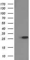 HPGD Antibody in Western Blot (WB)