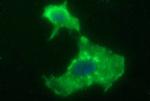 HPRT1 Antibody in Immunocytochemistry (ICC/IF)