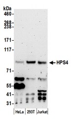 HPS4 Antibody in Western Blot (WB)