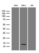 HPV18 E7 Antibody in Western Blot (WB)