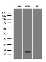 HPV18 E7 Antibody in Western Blot (WB)