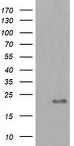 HRAS Antibody in Western Blot (WB)