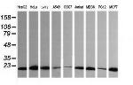 HRAS Antibody in Western Blot (WB)