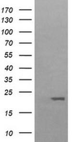 HRAS Antibody in Western Blot (WB)