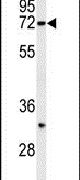 HRD1 Antibody in Western Blot (WB)