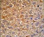 HRG Antibody in Immunohistochemistry (IHC)