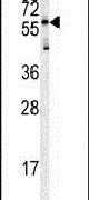 HRG Antibody in Western Blot (WB)