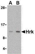 HRK Polyclonal Antibody