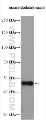 TRIM39 Antibody in Western Blot (WB)