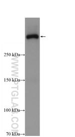 APOB Antibody in Western Blot (WB)