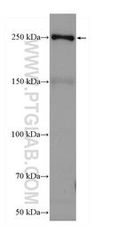 APOB Antibody in Western Blot (WB)
