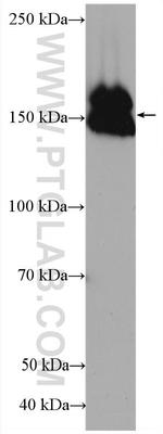 Collagen Type III Antibody in Western Blot (WB)