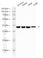 TDP-43 Antibody in Western Blot (WB)