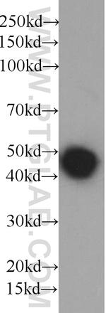 His-Tag Antibody in Western Blot (WB)