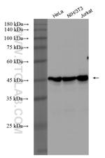 IgM Antibody in Western Blot (WB)
