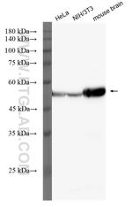 Beta Tubulin Antibody in Western Blot (WB)