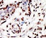 HRX Antibody in Immunohistochemistry (IHC)
