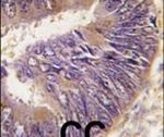 HIP Antibody in Immunohistochemistry (IHC)