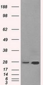 HSD17B10 Antibody in Western Blot (WB)