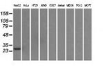 HSD17B10 Antibody in Western Blot (WB)