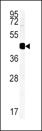 HSD17B2 Antibody in Western Blot (WB)