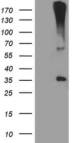 HSD17B3 Antibody in Western Blot (WB)