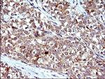 HSD17B4 Antibody in Immunohistochemistry (Paraffin) (IHC (P))