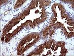 HSD17B4 Antibody in Immunohistochemistry (Paraffin) (IHC (P))