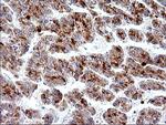 HSD17B4 Antibody in Immunohistochemistry (Paraffin) (IHC (P))