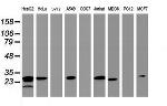 HSD17B8 Antibody in Western Blot (WB)