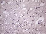 HSF2 Antibody in Immunohistochemistry (Paraffin) (IHC (P))