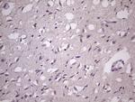 HSF2 Antibody in Immunohistochemistry (Paraffin) (IHC (P))