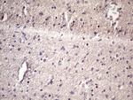 HSF2 Antibody in Immunohistochemistry (Paraffin) (IHC (P))