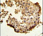 HSP90 beta Antibody in Immunohistochemistry (IHC)
