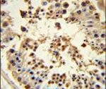 HSP90 beta Antibody in Immunohistochemistry (IHC)