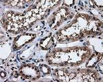 HSPA1A Antibody in Immunohistochemistry (Paraffin) (IHC (P))