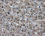 HSPA1A Antibody in Immunohistochemistry (Paraffin) (IHC (P))