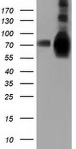HSPA6 Antibody in Western Blot (WB)