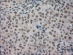 HSPA9 Antibody in Immunohistochemistry (Paraffin) (IHC (P))