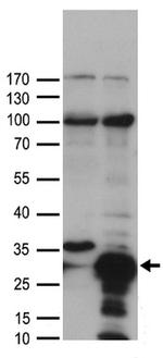 HSPB1 Antibody in Western Blot (WB)