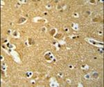 BABAM1 Antibody in Immunohistochemistry (IHC)